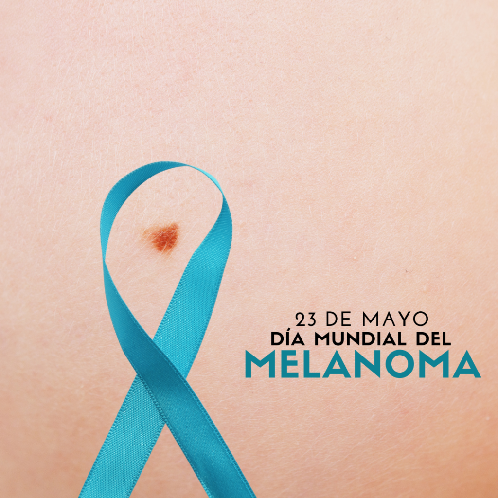 D A Mundial Contra El Melanoma Un Llamado A La Acci N Global Tenemosquehablar Com Mx