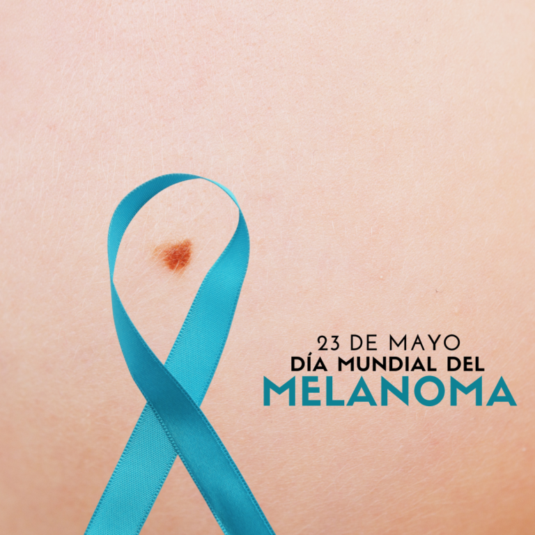 Día Mundial Contra El Melanoma Un Llamado A La Acción Global